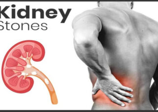 Treatment And Prevention Of Kidney Stones: