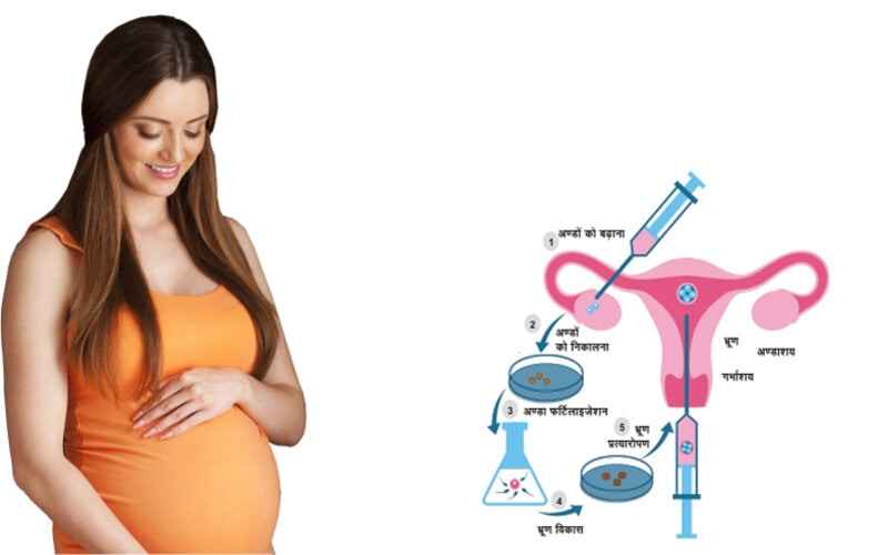 IVF Process- Understanding Complete Procedure Step By Step