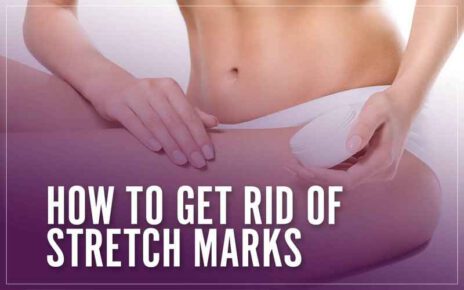 How to Remove Stretch Marks and Eye Bags Easily