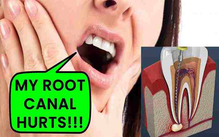 What Is Root Canal? Symptoms Root Canal