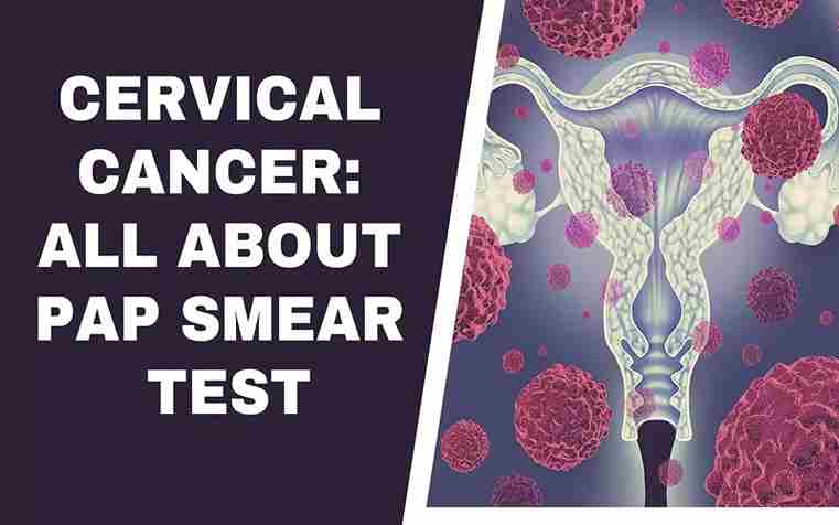 Pap Smear Test | Pap Smear (Pap Test): Reasons, Procedure