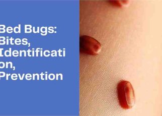 Mosquitoes, Bedbugs protection, pest controls