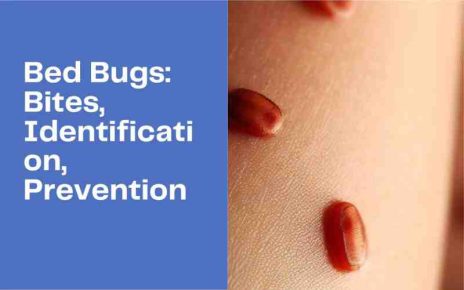 Mosquitoes, Bedbugs protection, pest controls